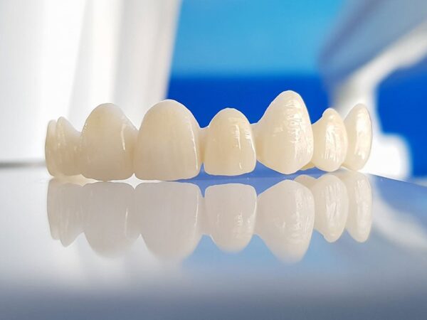 Răng sứ có tuổi thọ bao lâu? Răng sứ loại nào bền bỉ nhất?
