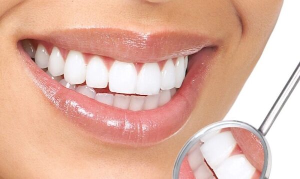 Top 6+ kem đánh răng cho răng sứ giúp răng sáng, khỏe nhất