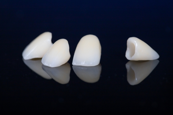 Răng sứ toàn sứ có độ bền chắc cao nhất trong các loại răng sứ 