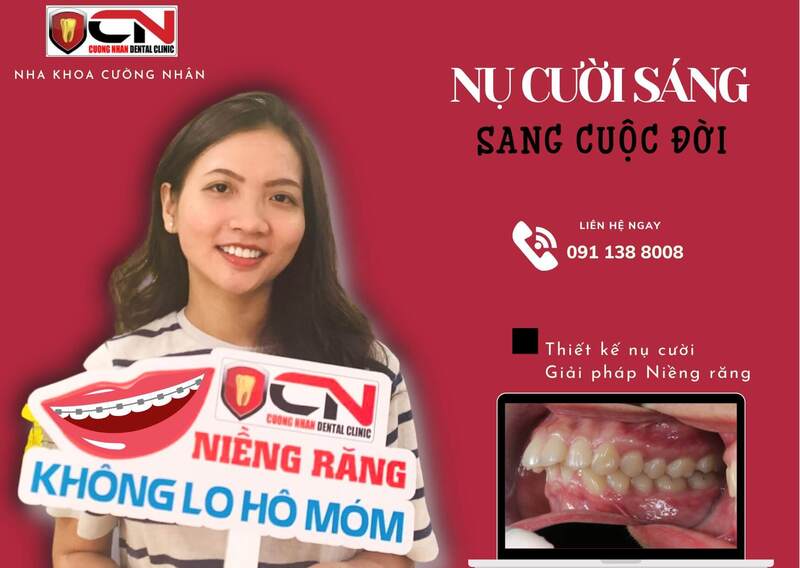 Nha Khoa Cường Nhân - cơ sở cung cấp dịch vụ bọc răng sứ chất lượng