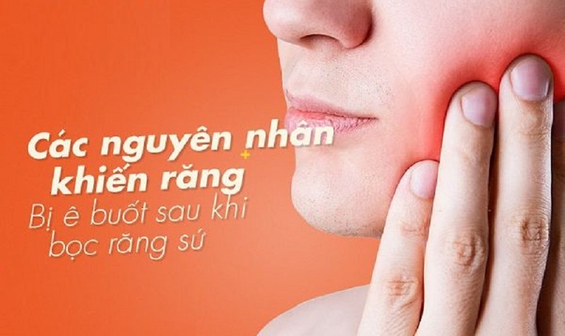 Tình trạng bọc răng sứ bị ê buốt có phổ biến hay không?