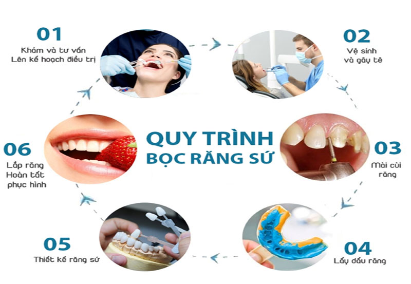 Quy trình bọc răng sứ kim loại tại Nha Khoa Cường Nhân