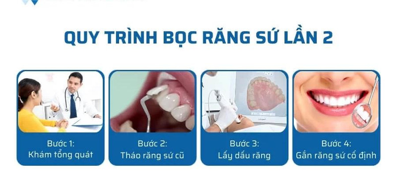 Quy trình bọc răng sứ lần 2 được diễn ra như thế nào?