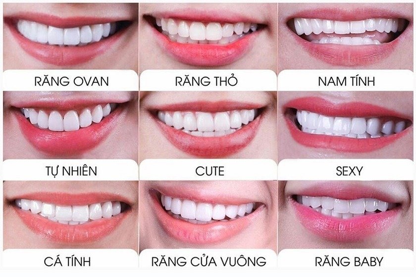 Có nhiều loại răng sứ khác nhau để bạn lựa chọn nhằm tăng tính thẩm mỹ cá nhân