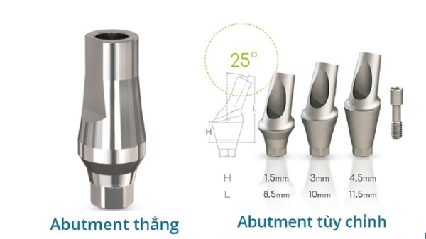 Phân loại Healing Implant theo hình dạng