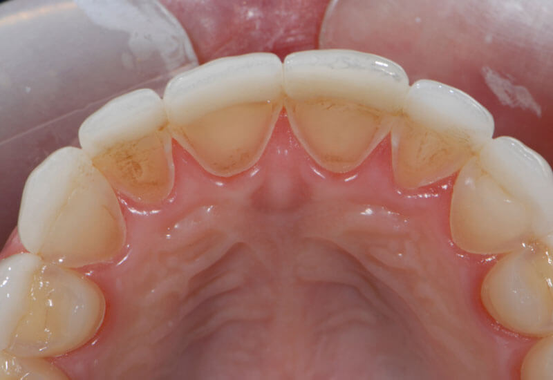 Các trường hợp phải đi khám răng