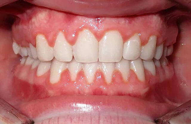 Hài hòa với tổng thể