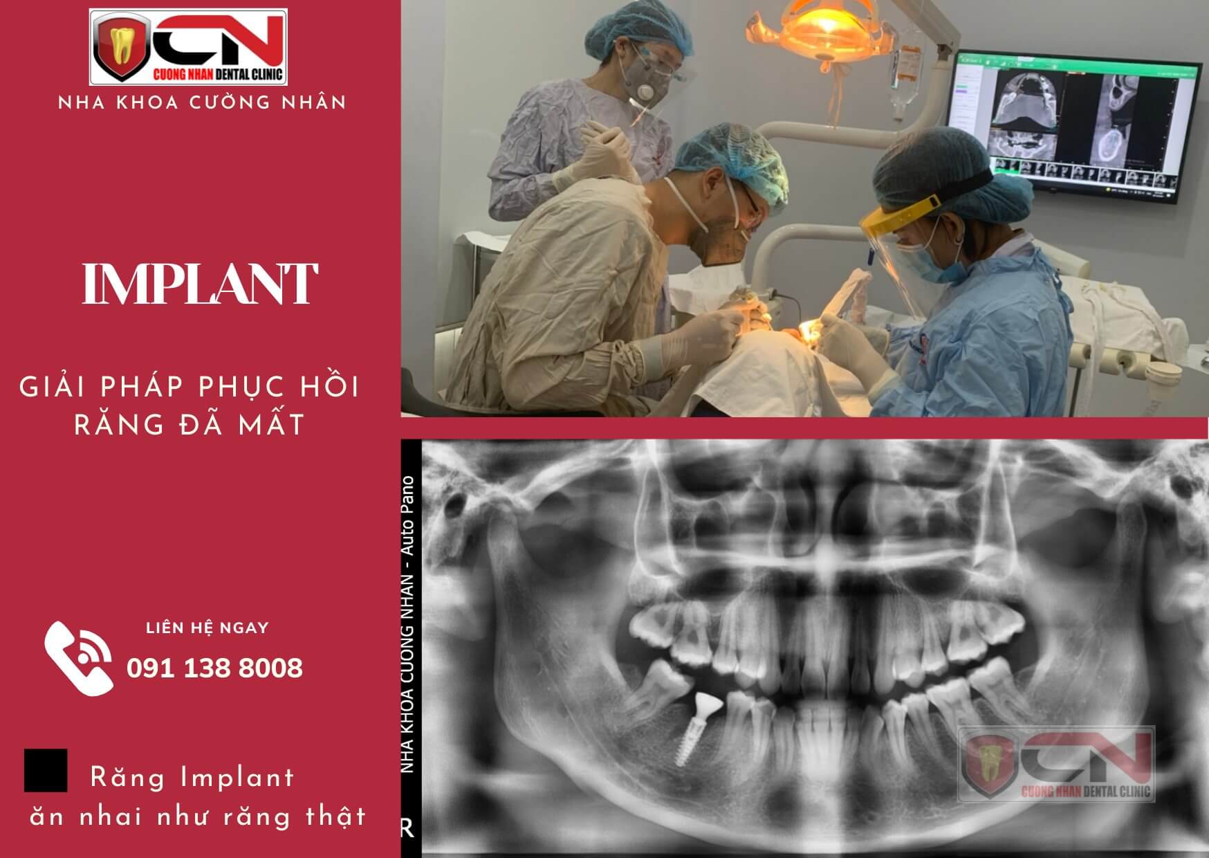 Nha Khoa Cường Nhân với đội ngũ y, bác sĩ hàng đầu