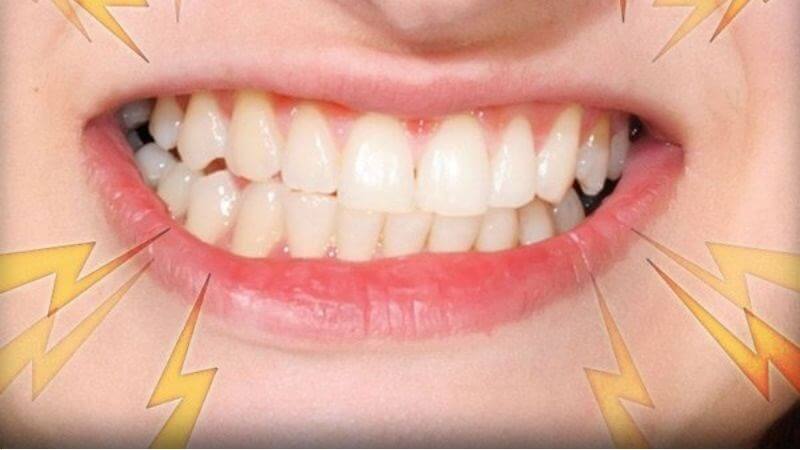 Nên điều trị sớm các bệnh lý về răng miệng