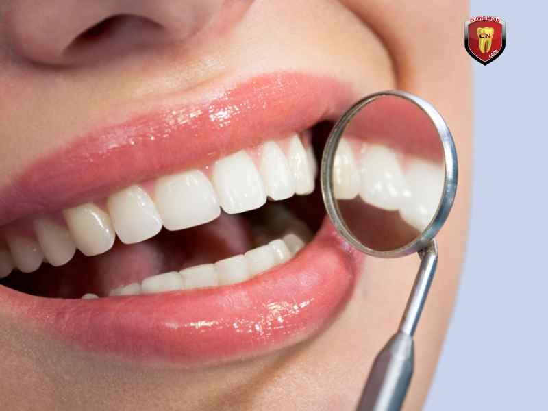 Câu Hỏi Thường Gặp Về Tình Trạng Trám Răng Bị Gãy