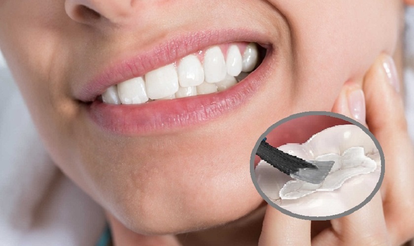 Trám răng bị nhức là tình trạng gì ?