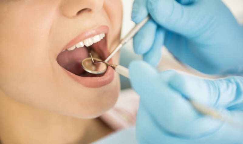 Tùy vào tình trạng mà giá sẽ khác nhau