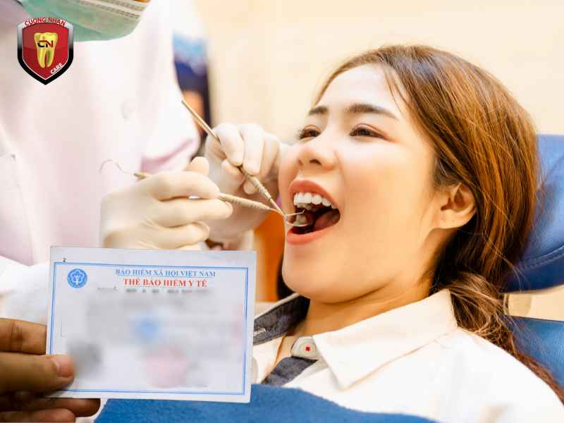 Tổng quan về trám răng và bảo hiểm y tế