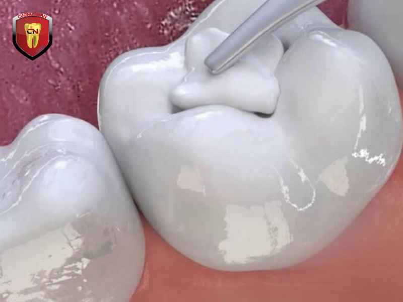 Nha Khoa Cường Nhân - đơn vị nha khoa uy tín tại Bình Dương