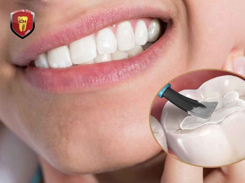 Cách phòng ngừa tình trạng trám răng bị đen