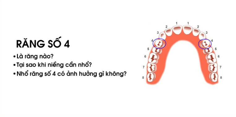 Tìm hiểu về răng số 4