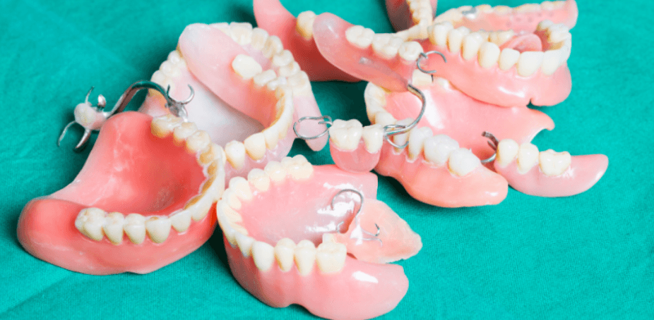 Răng giả tháo lắp