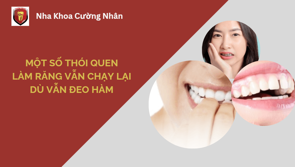 Một số thói quen làm răng dễ chạy lại dù vẫn đeo hàm
