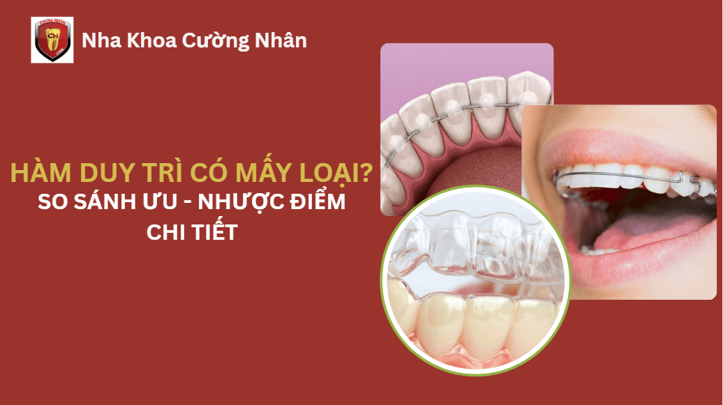 Hàm duy trì có mấy loại, ưu nhược điểm từng loại
