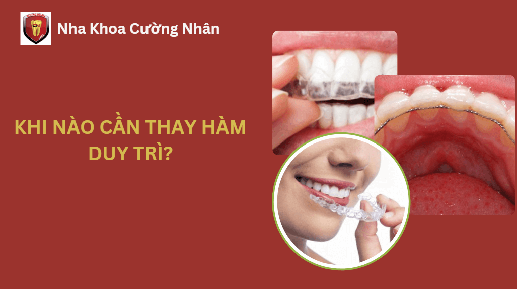 Khi nào cần thay hàm duy trì