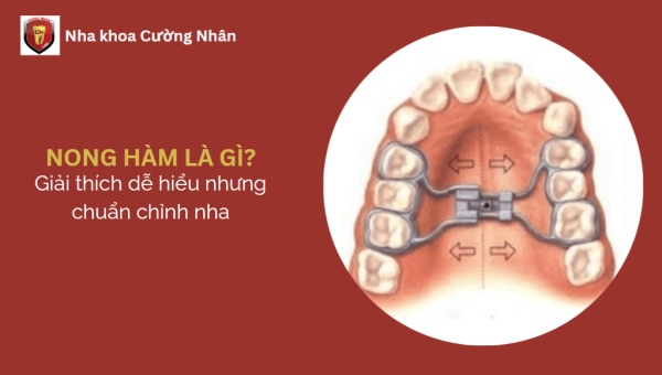 Tìm hiểu về nong hàm