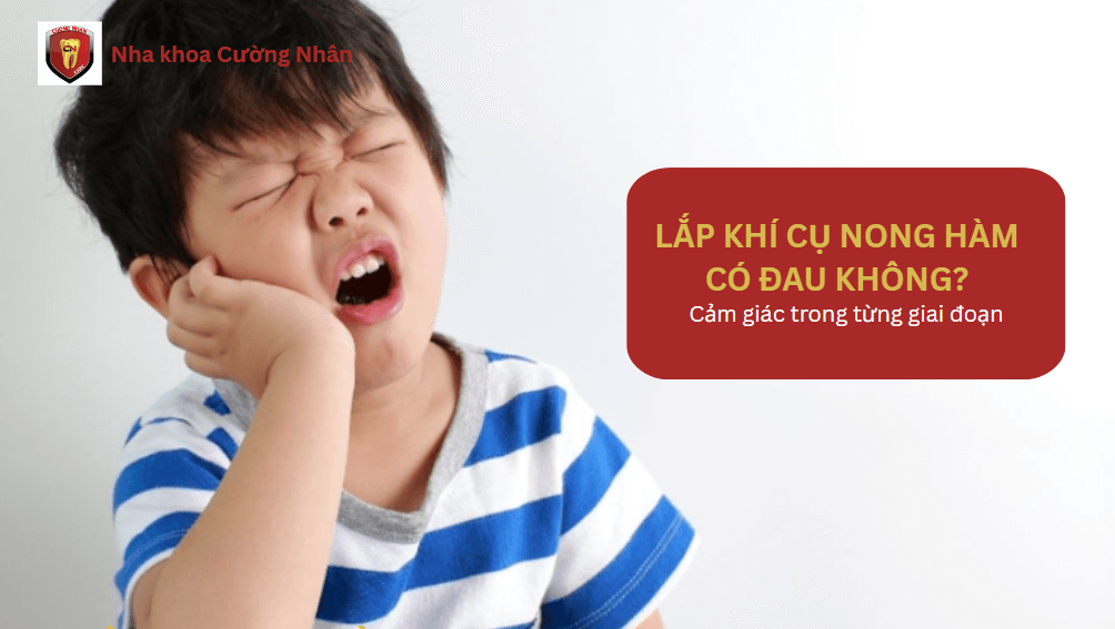 Khi lắp khí cụ nong hàm có đau hay không