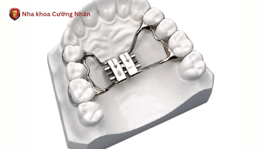 Phương pháp nong hàm nhanh