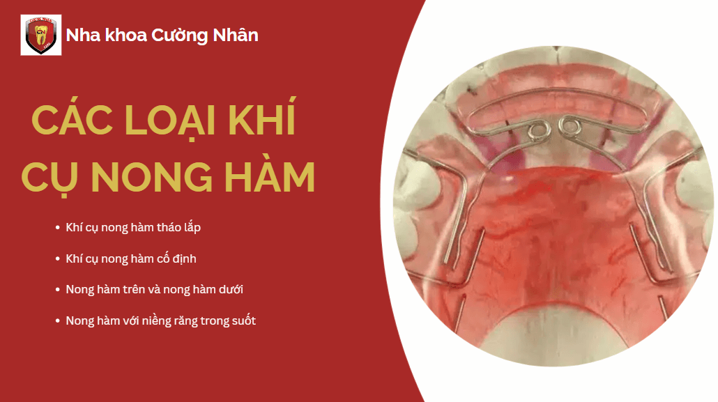 Các loại khí cụ nong hàm