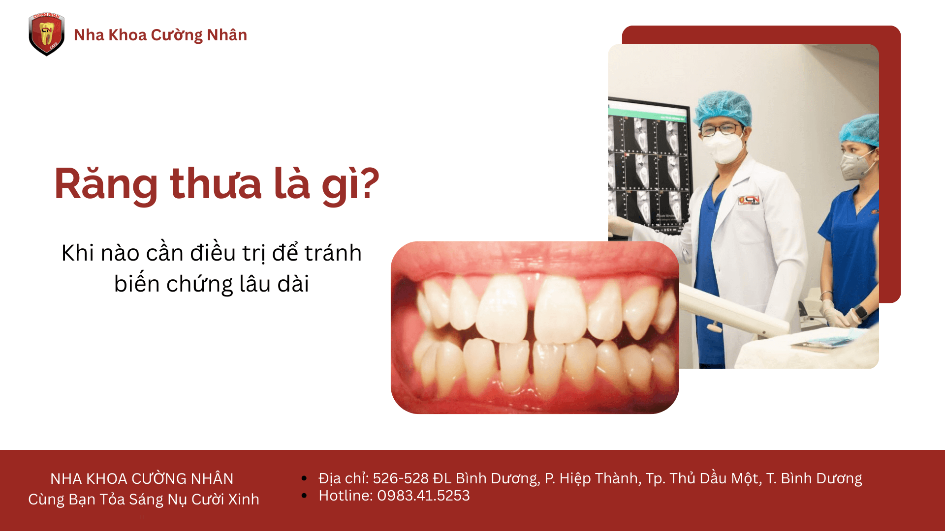 Tìm hiểu về răng thưa