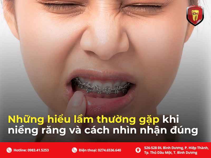 Những lỗi thường gặp khi siết dây cung