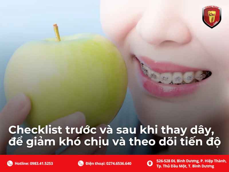 Checklist kiểm tra trước và sau khi sử dụng dây cung niềng răng