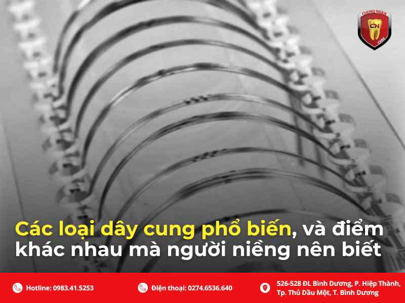 Các loại dây cung niềng răng phổ biến