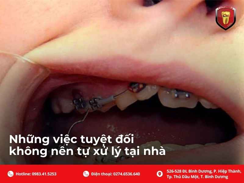 Checklist xử lý an toàn khi phát hiện dây cung bị cong