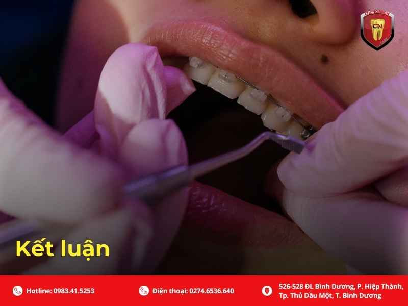 Câu hỏi thường gặp về nuốt dây cung niềng răng