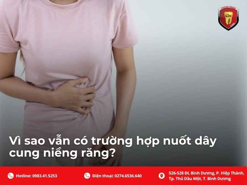 Nuốt dây cung niềng răng có nguy hiểm không?