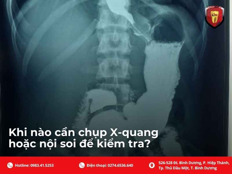 Cách xử lý đúng khi lỡ nuốt dây cung niềng răng