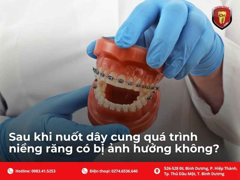 Khi nào cần chụp X-quang hoặc nội soi để kiểm tra?