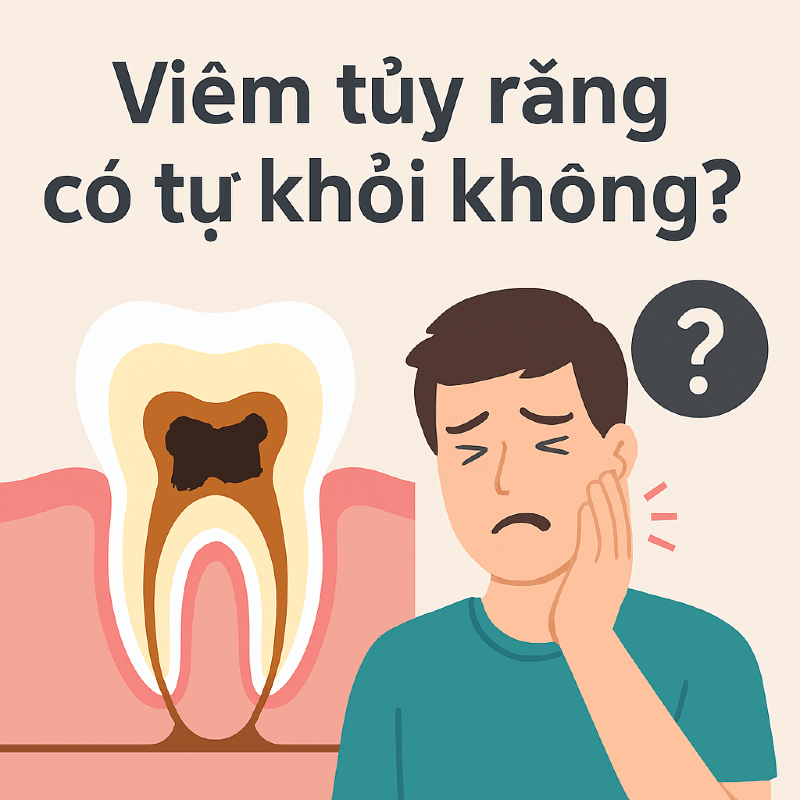 Viêm tủy răng có tự khỏi không?