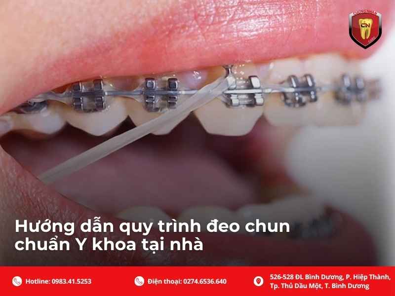 Hướng dẫn quy trình đeo chun chuẩn Y khoa tại nhà