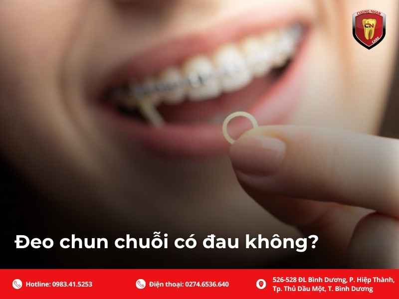Đeo chun chuỗi có đau không?