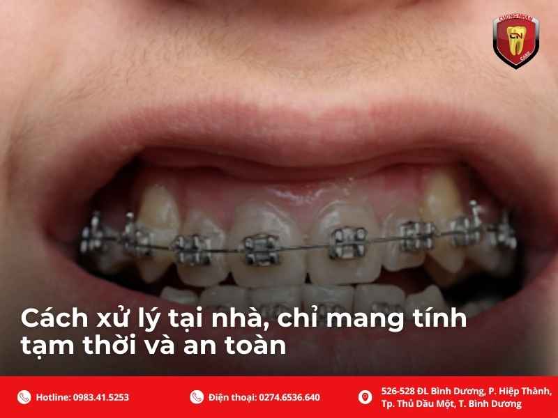 Cách xử lý tại nhà, chỉ mang tính tạm thời và an toàn