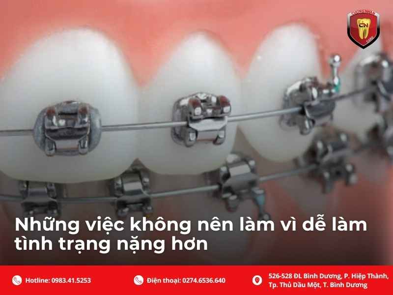 Những việc không nên làm vì dễ làm tình trạng nặng hơn