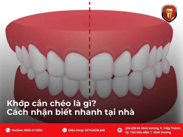 Khám phá dấu hiệu