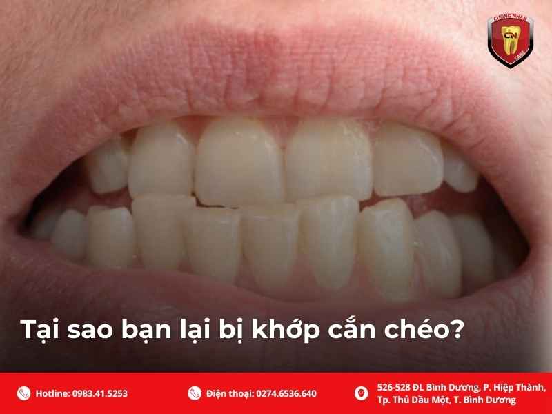  và các giải pháp điều trị từ niềng răng đến phẫu thuật tại Nha khoa Cường Nhân. Bí quyết sở hữu nụ cười cân đối cho mọi lứa tuổi.