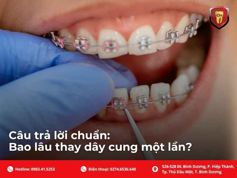 Câu trả lời chuẩn: Bao lâu thay dây cung một lần?