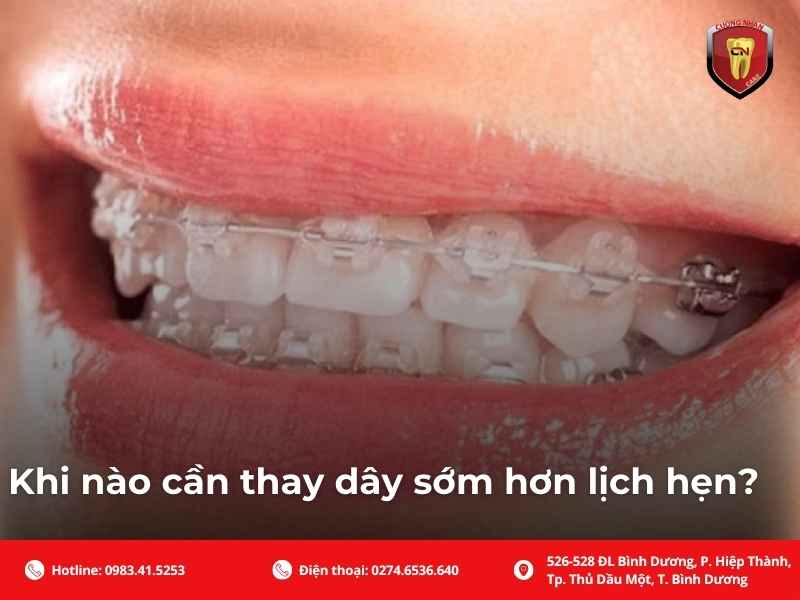 Khi nào cần thay dây sớm hơn lịch hẹn?