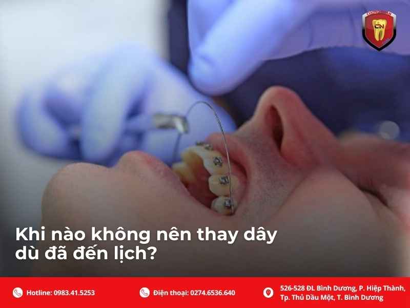 Khi nào không nên thay dây dù đã đến lịch?