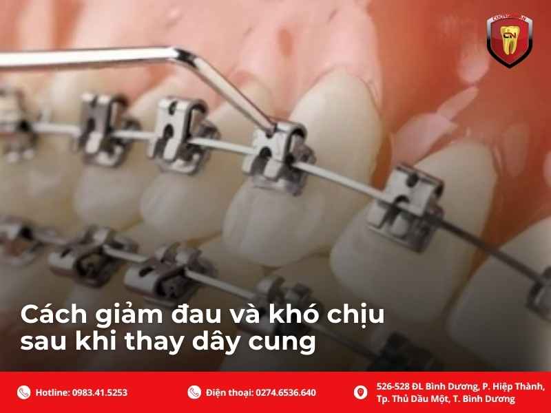 Cách giảm đau và khó chịu sau khi thay dây cung