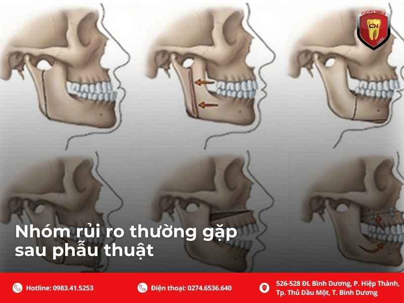 Journal of Oral and Maxillofacial Surgery