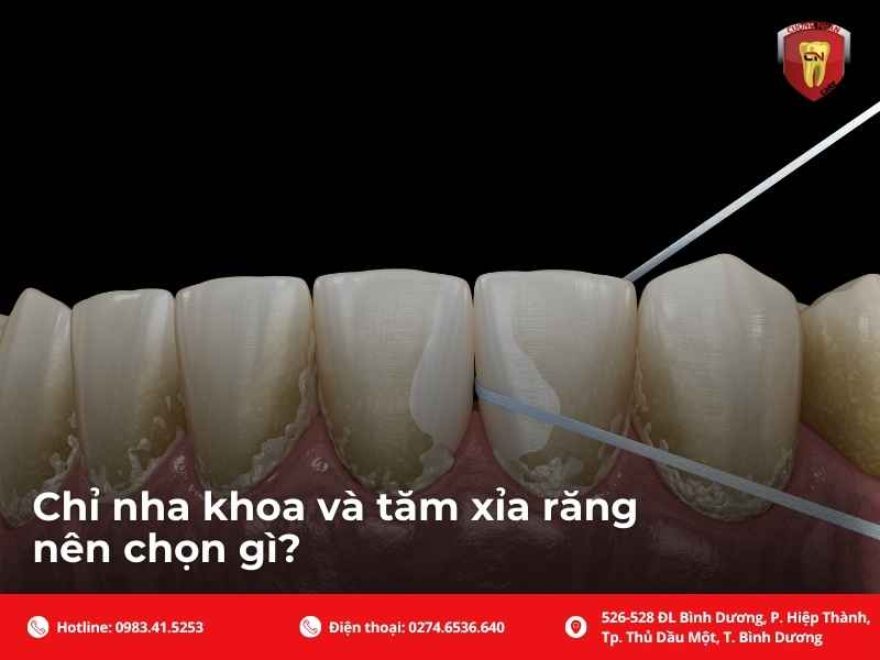 Chỉ nha khoa và tăm xỉa răng nên chọn gì?